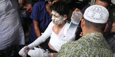 Death toll rises to 20, injured 171