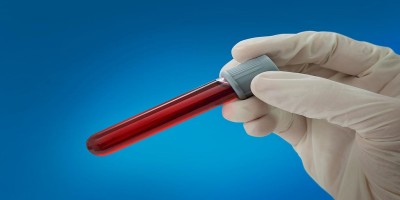 Blood test for more than 50 cancers delivers 'exciting' results