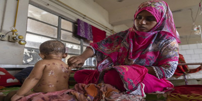 Urgent measles vaccination to be launched in 30 upazilas Sunday