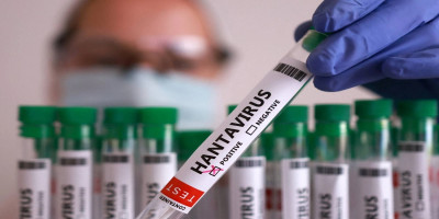 Hantavirus infection is not a confirmed side effect of Pfizer's COVID-19 vaccine